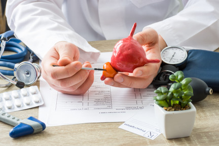 Prostatectomia: quando a cirurgia de próstata é realmente necessária?