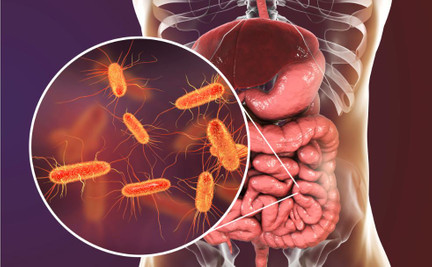 Microbioma intestinal: o que é, qual a sua função e por que fazer o exame?